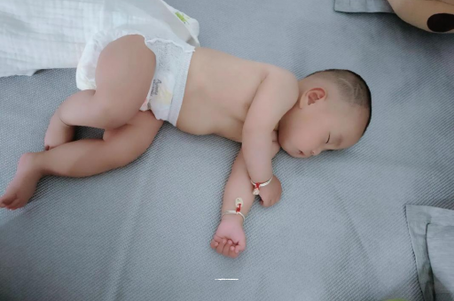 枣阳宝宝褶皱处擦粉还是油